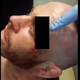Illustration for article titled MMA Fighter Takes Knee To The Face, Suffers Extremely Gnarly Head Wound